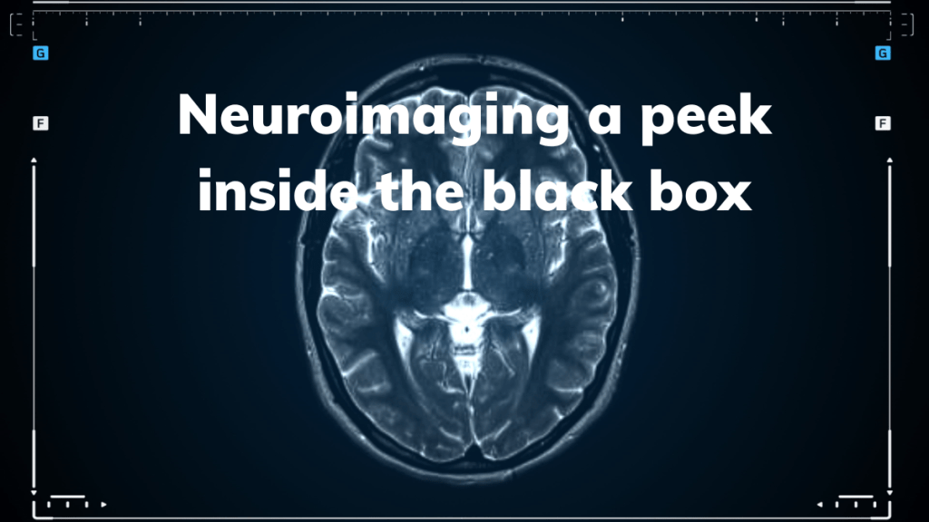 Peering Inside the Black Box: How Neuroimaging is Revolutionizing Stroke&nbsp;Recovery