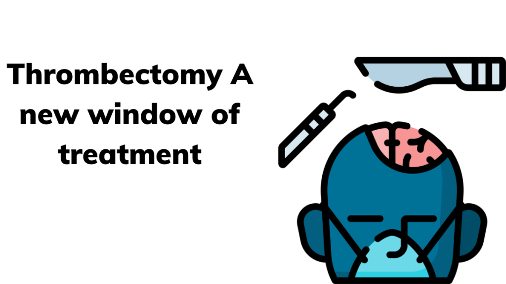 Thrombectomy: It’s not Just a “Golden Hour”&nbsp;Anymore!